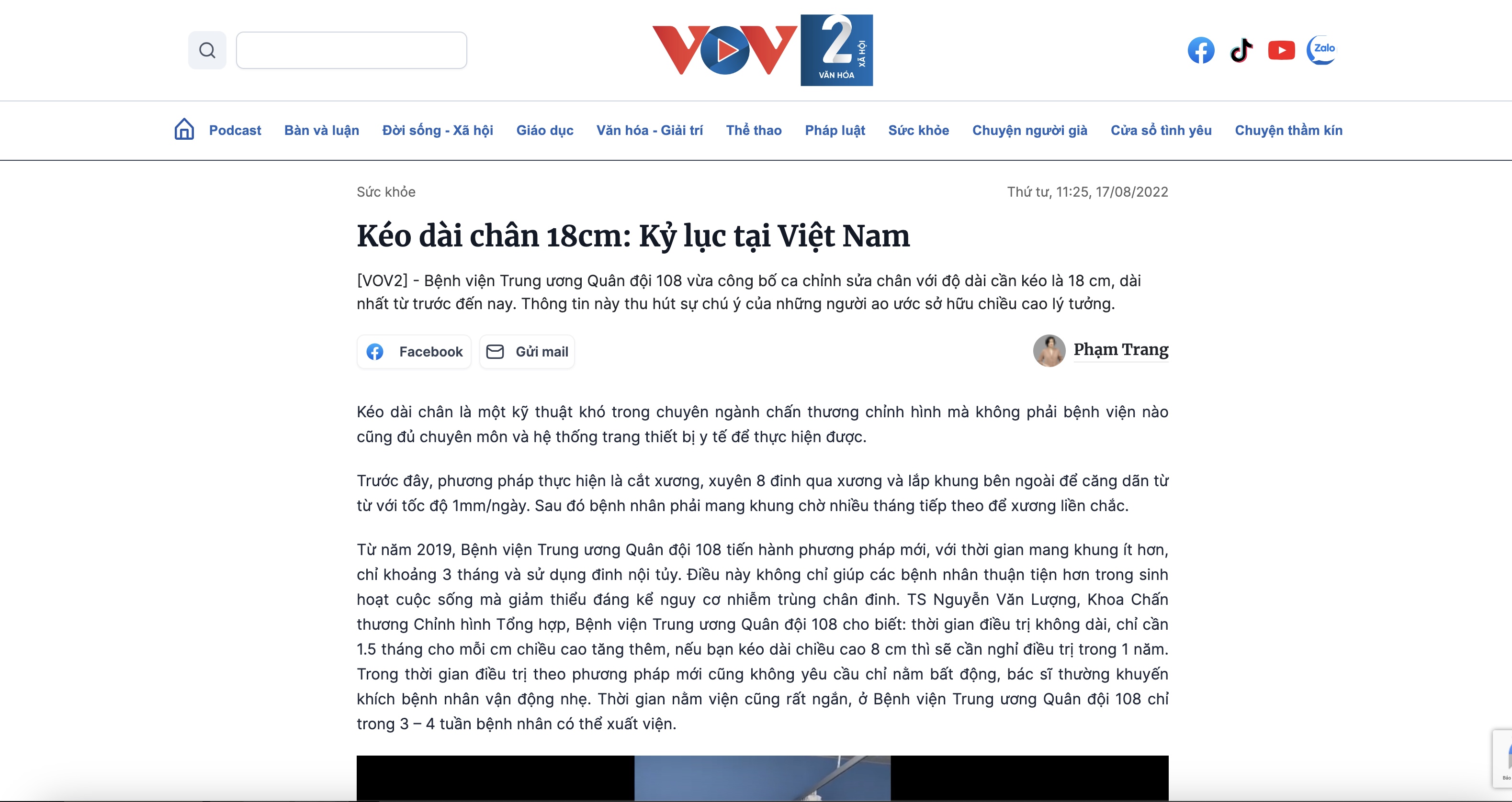 VOV2 ca kỷ lục kéo dài chân 18cm